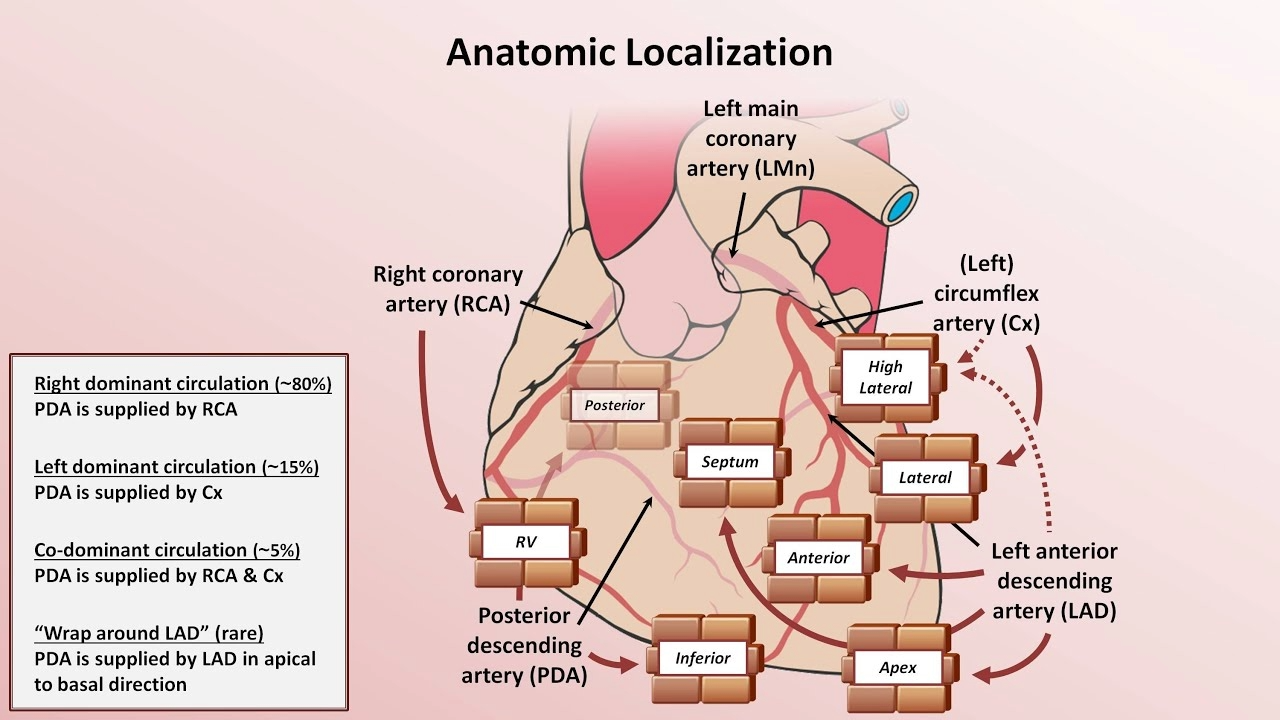 Cracking the Code-A Human Take on Reading Myocardial Infarction on ECG